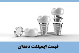 قیمت ایمپلنت دندان