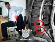 چگونه از دیسک کمر در کار اداری جلوگیری کنیم؟ علائم پنهان و پیشگیری مؤثر