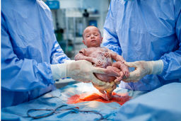 زایمان سزارین در چند هفتگی انجام می‌شود؟