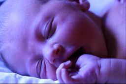 کولیک نوزاد و ارتباط آن با زردی چیست؟ | دلایل، نشانه‌ها و راهکار درمان


