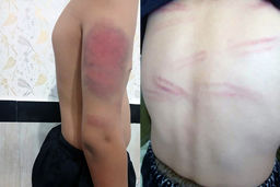 احضار معلم آزارگر به دادسرا/آخرین وضعیت پرونده تنبیه بدنی دانش‌آموزان روستای کرجوی سنندج