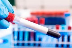 پیشرفت شگفت‌انگیز در پیش‌بینی ابتلا به سرطان