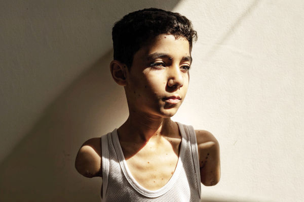 مامان حالا می‌توانم اشک‌هایم را پاک کنم؟/ درباره عکس سال ۲۰۲۵